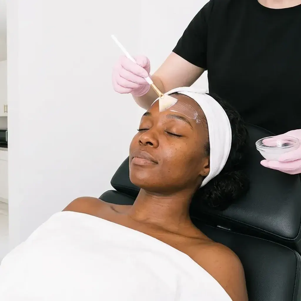 Chemical Peels in Phoenix, AZ
