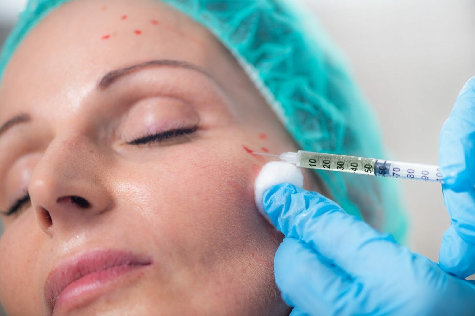 PRP Undereye Treatment in Phoenix | FAQs | Rouge & Wright