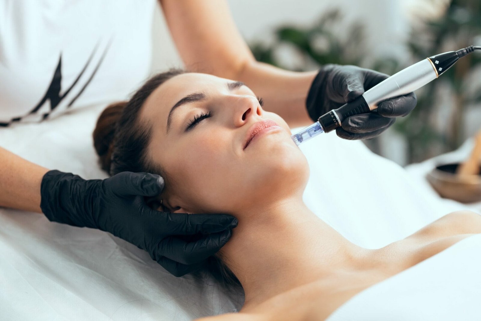 Get Smoother, Firmer Skin with Microneedling | Rouge & Wright