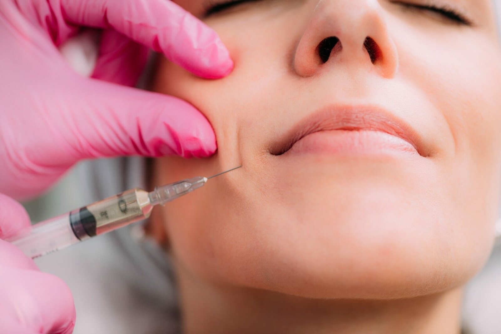 Smooth Wrinkles with Dermal Fillers | Phoenix Med Spa | Rouge & Wright