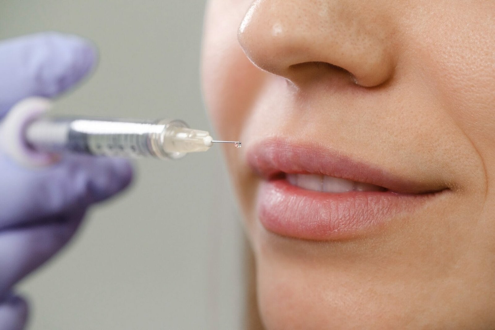 Lip Flip for Fuller Upper Lip | Phoenix Med Spa | Rouge & Wright