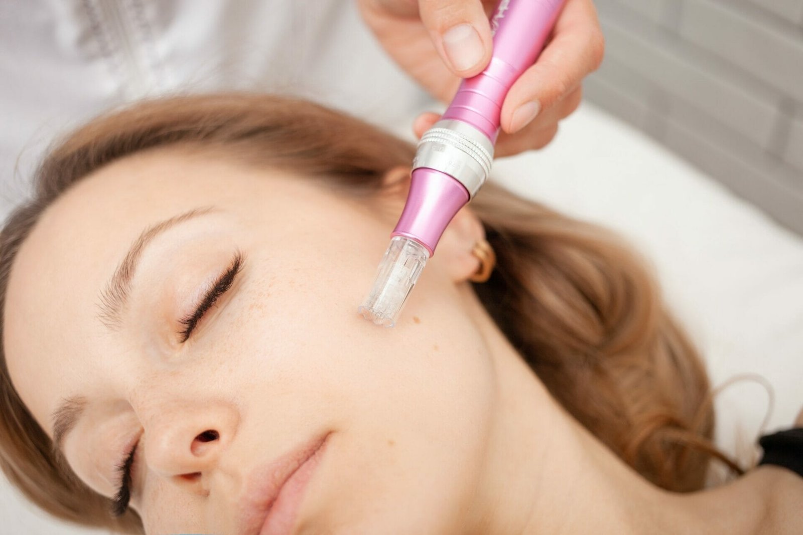 Discover the Benefits of Microneedling: Guide | Rouge & Wright